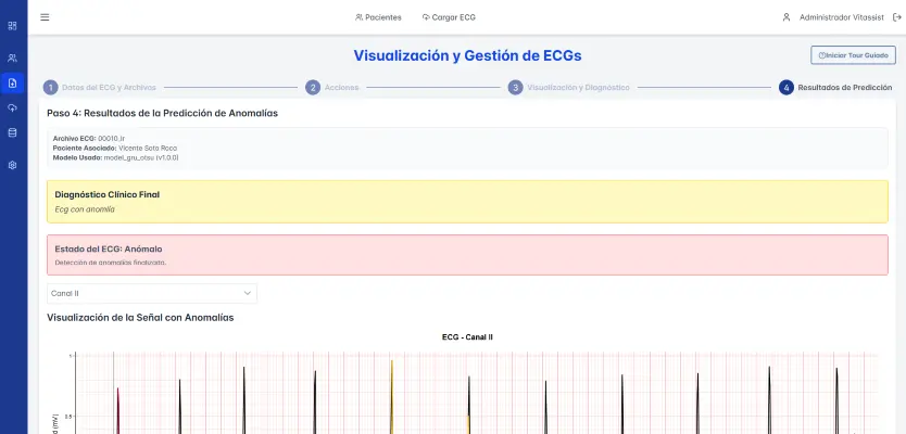 Sistema de Visualización y Análisis de ECG